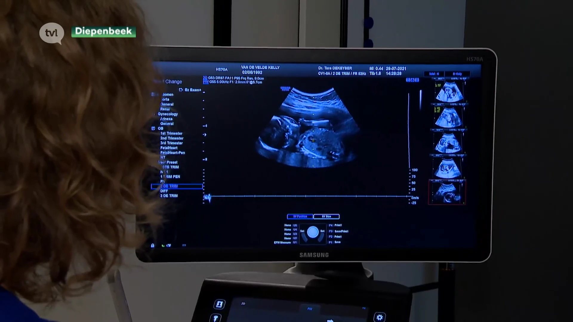Baby’s hebben al roet in hun longen en hersenen nog voor de geboorte