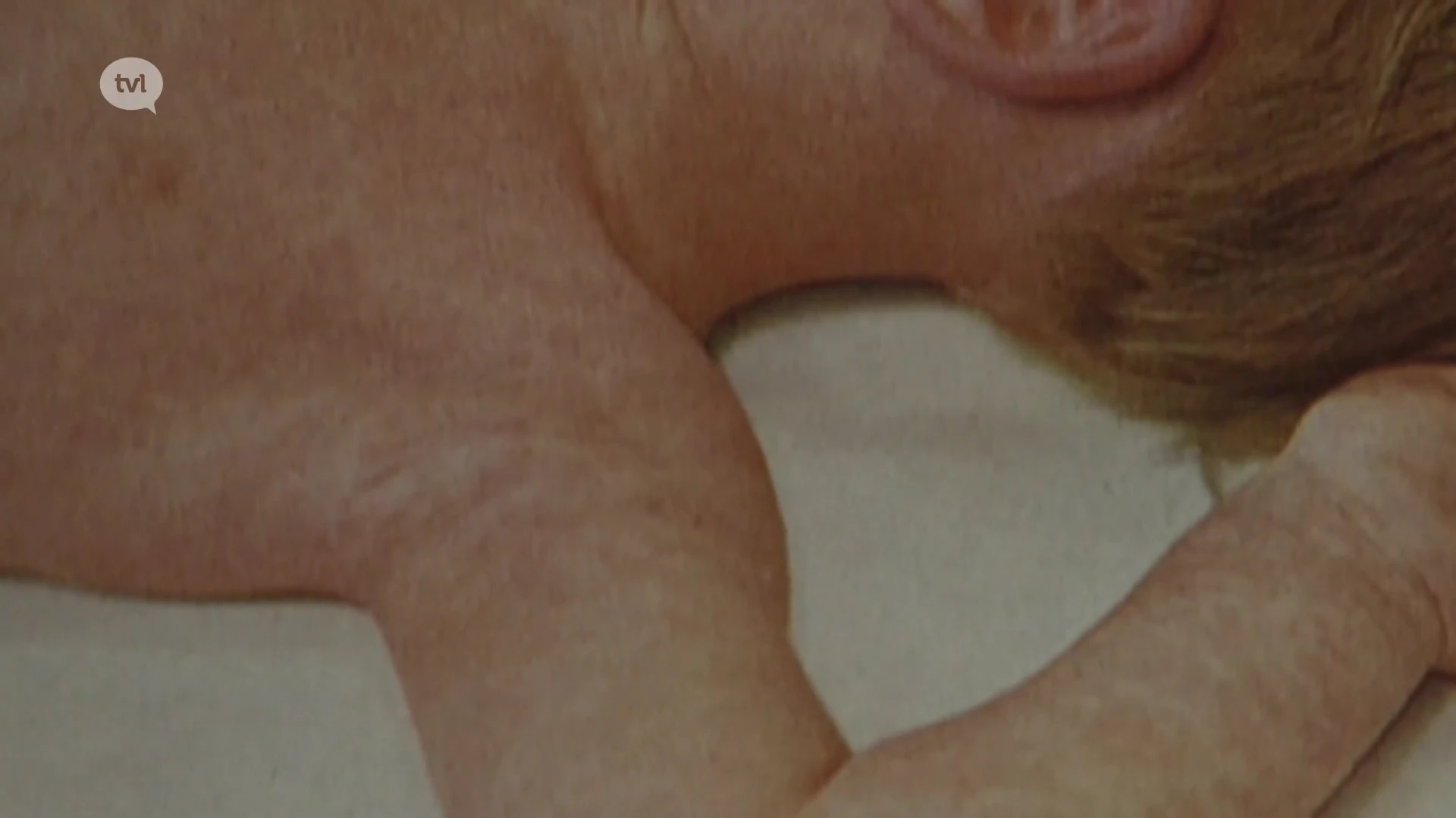 Mazelen weer in opmars: virologen roepen dertigers en veertigers op om te controleren of ze gevaccineerd zijn