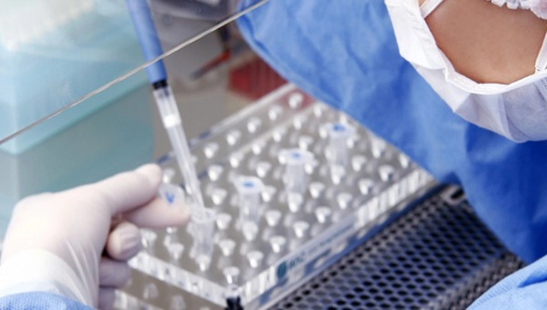 Belgische Charcot Stichting kent 30.000 euro toe aan MS-onderzoek UHasselt