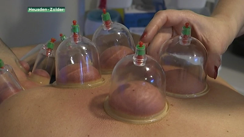 Cuppingmassage is nieuwste rage en komt overwaaien uit de China
