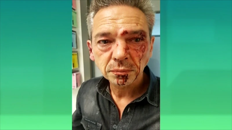 Werkstraf voor man die Hasseltse restauranteigenaar in elkaar sloeg