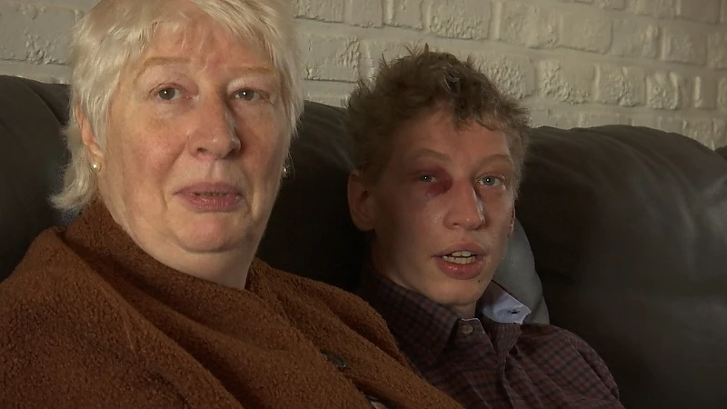 Jongeren slaan Lommelaar met beperking in elkaar