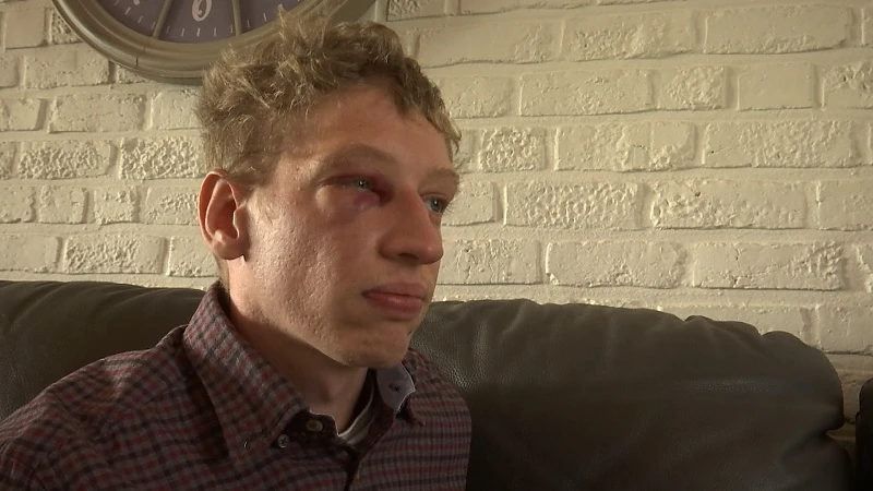 Lommelse Kevin heeft nu vooral nood aan rust, nadat jongeren hem in elkaar sloegen