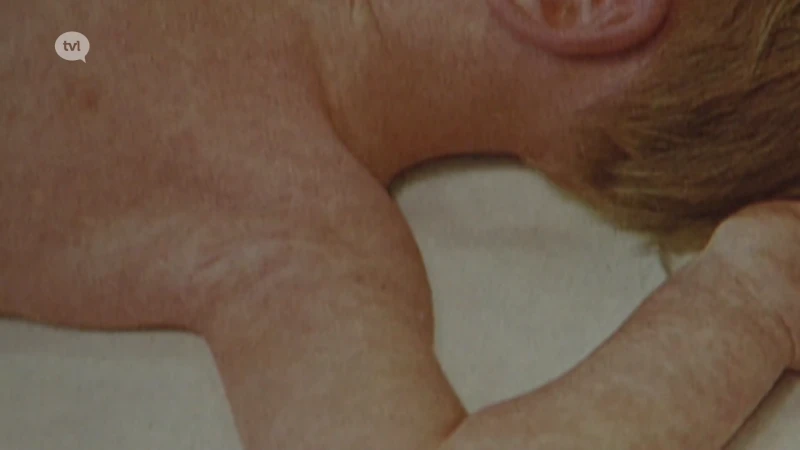 Mazelen weer in opmars: virologen roepen dertigers en veertigers op om te controleren of ze gevaccineerd zijn