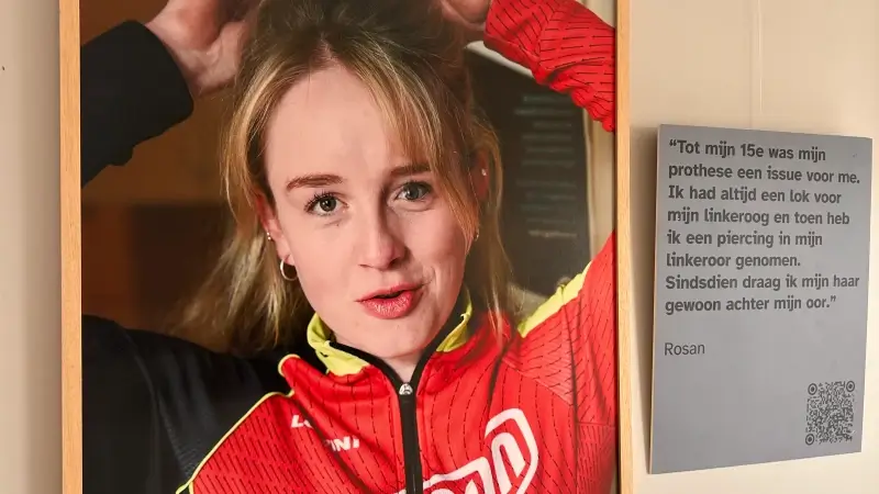 Expo 'Oog in Oog' belicht het leven met een oogprothese