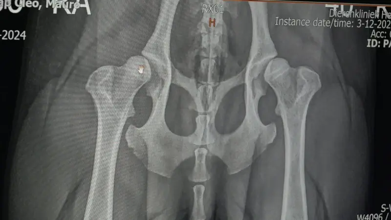 Hoofdafbeelding voor artikel 3D-geprinte heupoperatie in…